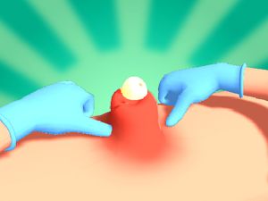 Spēle Pūtīte izspiest online