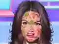 Spēle Princeses ādas ārsts online Spēle Princeses ādas ārsts online
